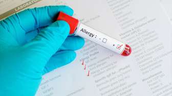 Berbeda Dengan Batuk Pilek: Ketahui Kondisi, Gejala, dan Cara Mengobati Rinitis Alergi