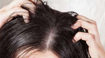 Antirusak, Ini 5 Cara Merawat Rambut Buat Kamu yang Berhijab