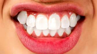 Tak Gosok Gigi Selama 10 Tahun, Perempuan Ini Akui Giginya Sehat
