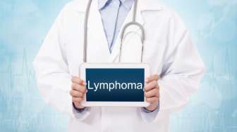 Kanker Limfoma Hodgkin: Faktor Risiko, Gejala, Hingga Pilihan Pengobatan