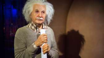 Sindrom Unik Ini Bikin Rambut Jabrik Mirip Einstein