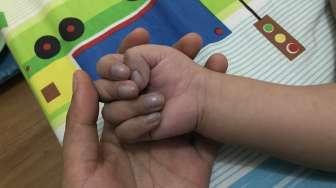 Kisah Haru Itmam, Bayi yang Mengidap Penyakit Begitu Kompleks