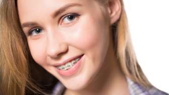 4 Perawatan Gigi Berbehel Ini Wajib Kamu Perhatikan