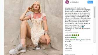 Gara-gara Kaki Berbulu, Model Cantik Ini Viral