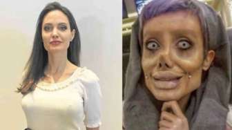 Perempuan yang Oplas 50 Kali Biar Mirip Angelina Jolie Cuma Hoax