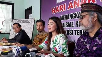 Tsania Marwa Ngadu ke Komnas Anak, Ini Hasilnya