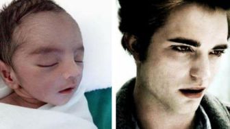 Viral, Bayi Baru Lahir Ini Mirip dengan Robert Pattinson
