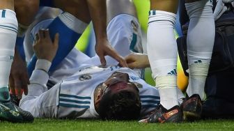 Mata Bengkak, Ronaldo Absen Bela Madrid di Piala Raja