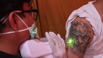 Layanan Hapus Tatto Gratis