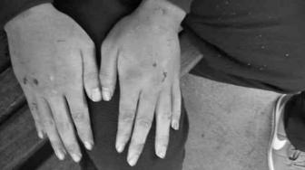 Remaja Terbelakang Mental Korban Aniaya Pamdal Alami Trauma