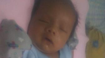 Kisah Rayyan, Bayi Asal Depok yang Terlahir Tanpa Anus