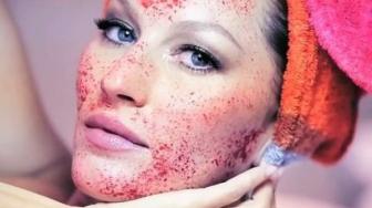 Vampire Facial Treatment  Kabarnya Bisa Picu HIV dan Hepatitis