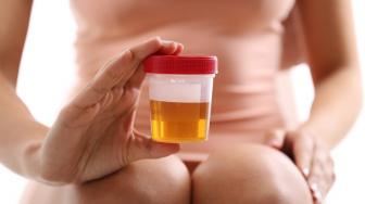 Penyebab Urine Berwarna: Benarkah Selalu Karena Idap Suatu Penyakit?
