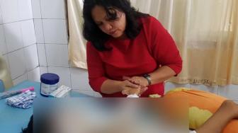 Sadis! Gadis 9 Tahun Dibakar Ibu Kandungnya Sendiri