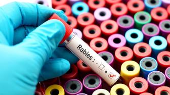 Mesti Tahu Nih, Begini Pertolongan Pertama Saat Terinfeksi Rabies