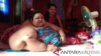 Titi Wati Perempuan Berbobot 350 Kg Sukses Jalani Operasi Bariatrik