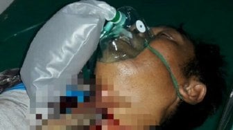 Senjata Makan Tuan, SN Tertancap Pisau di Leher Saat Mau Bunuh Selingkuhan