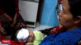 Akibat Serangan Kera Liar, Bayi Berusia 40 Hari Alami Luka Serius