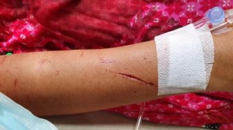Ingin Rujuk Usai Lebaran, Suami Kalap Lukai Istri di 