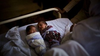 Kejadian Langka! Lahirkan Bayi Kembar Beda Ayah, Seorang Wanita Lakukan Ini