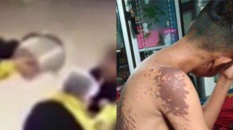Cinta Ditolak,Pria Ini Tega Siram Air Keras ke Anak Wanita Idamannya