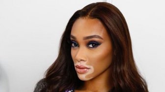 Berfoto di Kelas Ekonomi Pesawat, Model Winnie Harlow Panen Hujatan