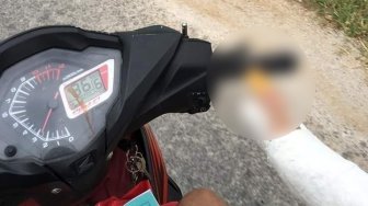 Patah Tulang Tangan Kanan, Trik Unik Naik Motor Ini Bikin Salah Fokus