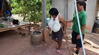 Payudara Terus Membesar, Dokter Kebingungan Diagnosa Penyakit Wanita Ini
