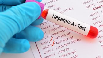UKHSA Menambahkan Dugaan Penyebab Hepatitis Akut Misterius: Virus Corona Omicron