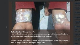 Viral Taruh Bawang Putih di Tangan Bisa Atasi Sakit Gigi, Ternyata Hoaks!