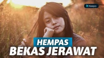 Demi Wajah Kinclong, Ini Cara Alami buat Menghilangkan Bekas Jerawat