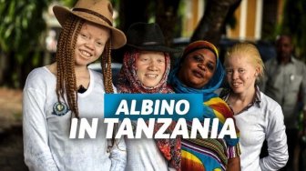 Kisah Tragis Orang Albino di Tanzania yang Dianggap Bak Titisan Iblis