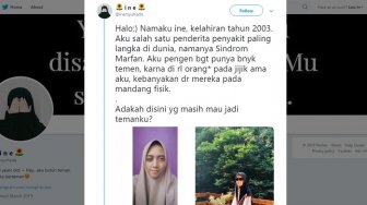 Viral Curhatan Gadis Penderita Sindrom Marfan, Ketahui Fakta Penyakit Langka ini!