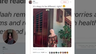 Dapat Dukungan Warganet, Gadis Ini Hanya Punya Satu Mata Sejak Lahir