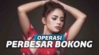 Operasi Perbesar Bokong, Dinar Candy Dongkrak Penampilan DJ Internasional