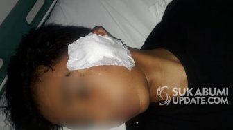 Kondisi Terkini Pelajar MTs Korban Tawuran di Cicurug