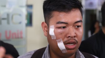 Seorang mahasiswa bernama Naufal Nabil Siregar korban kericuhan memberi keterangan kepada wartawan di Rumah Sakit Pusat Pertamina, Jakarta, Rabu (25/9). [Suara.com/Angga Budhiyanto]