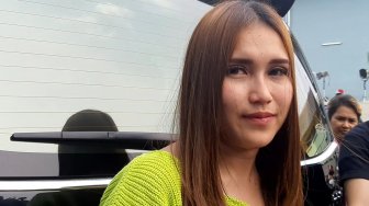 Ayu Ting Ting Ngaku Cedera Engkelnya Sering Kambuh