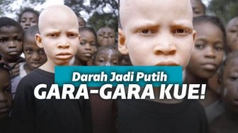 Sering Makan Kue, Pria ini Jadi Alien, Darahnya Seputih Susu!