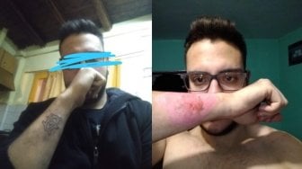 Demi Masuk Polisi, Pria Asal Argentina Hapus Tato Pakai Parutan Keju