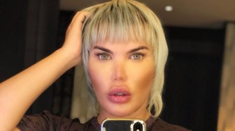 Obsesi Operasi Plastik, Rodrigo Alves: Dulu Keinginan, Sekarang Kebutuhan