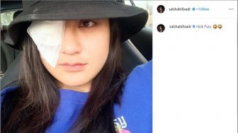 BRUK! Artis Salshabilla Adriani Tabrakan di Kemang karena Mabuk-mabukan