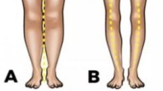 Tes Kepribadian: Bentuk Kaki Cermin Perilaku di Tempat Tidur, Anda yang Mana?