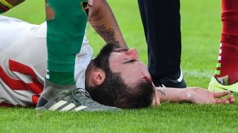 Pemain depan Juventus Gonzalo Higuain tergeletak setelah bertabrakan dengan kiper Lecce selama pertandingan sepak bola Serie A Italia antara Lecce melawan Juventus di Stadio Comunlae Via del Mare, Lecce, Sabtu (27/10). [Alberto PIZZOLI / AFP]