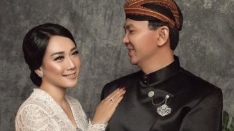 Punya Pipi Chubby Seperti Puput Nastiti Devi? 