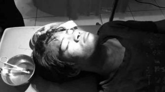 Dipukul Oknum Security PT KDA, Warga SAD Dilarikan ke RSUD Bangko