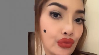 Bibir Irma Darmawangsa Ikutan Dower, Sindir Barbie Kumalasari?