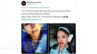 Mengenal Rhinoplasty, Operasi Hidung yang Dilakukan Puteri Novitasari Ramli