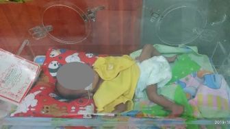 Bayi Delfa Hampir 4 Bulan Ditahan RS, Orang Tua Tak Mampu Bayar Tagihan