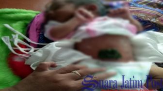 Tali Pusar Bayi di Situbondo Dibungkus Daun, Ini Resikonya